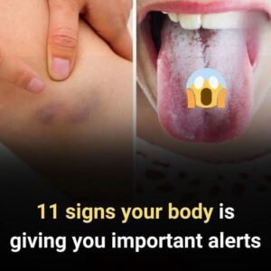 11 warning signs your body gives about your health