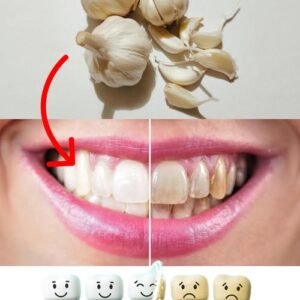Improve Your Oral Health Naturally with Garlic