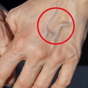 If you have visible veins, it means…