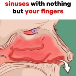 Clear Your Sinuses Instantly Using Just Your Finger