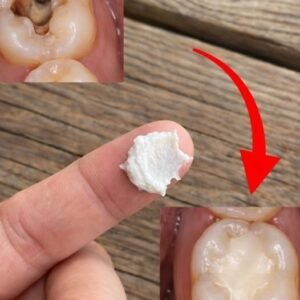 Natural Ways to Protect Teeth