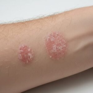 Warning Signs to See Doctor