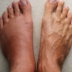 One Month Before a Heart Att.ack, Your Body Will Alert You: Here Are the 6 Symptoms!