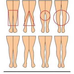 A WOMAN’S LEGS CAN TELL HOW HER IS
