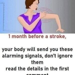 Stroke: These indicators that manifest one month prior to..