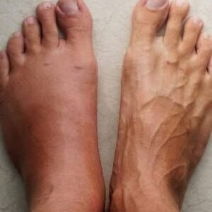 One Month Before a Heart Att.ack, Your Body Will Alert You: Here Are the 6 Symptoms!