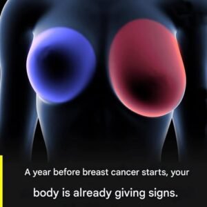 Breast cancer: 4 early signs every woman should know.