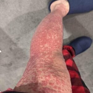 These are the consequences of sleeping with…