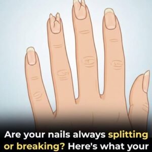 If Your Nails Look Like This, It’s Time for a Check-Up