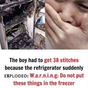 The boy had to get 38 stitches because the refrigerator suddenly ᴇxᴘʟᴏᴅᴇᴅ