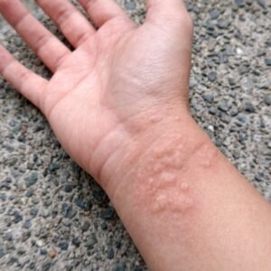 These are the consequences of sleeping with…