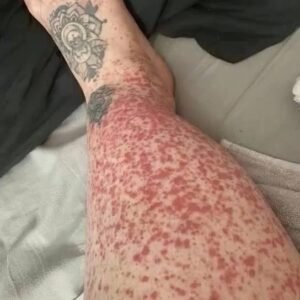 These are the consequences of sleeping with…See more