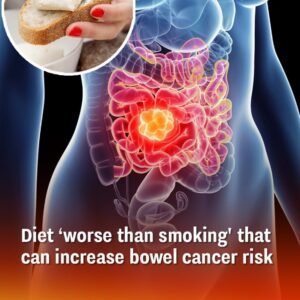 Diet ‘worse than smoking’ that can increase bowel cancer risk