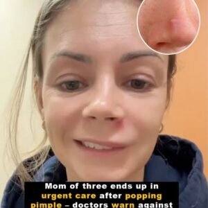 Danger Triangle Pimple Warning