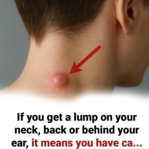 Got a lump on your neck, back or behind your ear? This is what you need to know