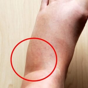 These are the consequences of sleeping with…