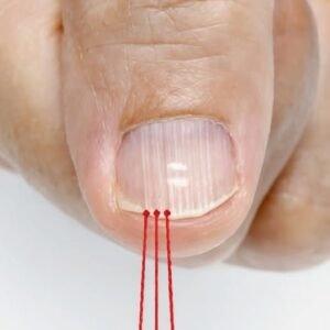 Nail Lines Warning Sign