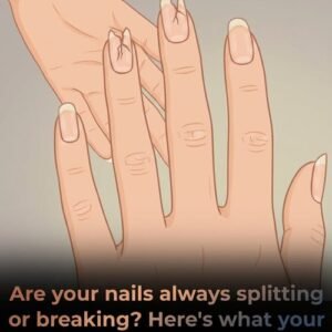 If Your Nails Look Like This, It’s Time for a Check-Up