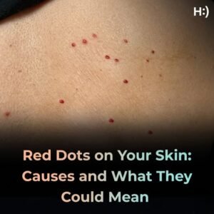 Red dots on your skin: Causes and what they could mean