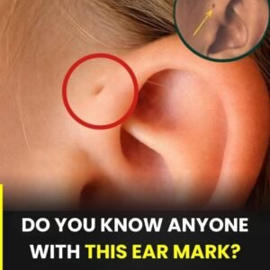 A Tiny Mark by the Ear: Understanding a Common Natural Variation