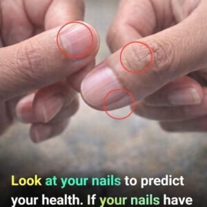 Reading the Signs: A Practical Guide to Understanding Nail Lines