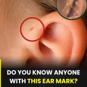 A Tiny Mark by the Ear: Understanding a Common Natural Variation