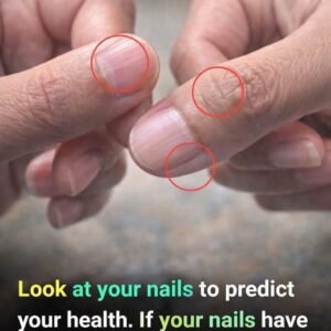 Reading the Signs: A Practical Guide to Understanding Nail Lines