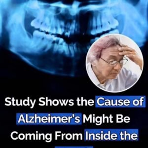 The cause of Alzheimer’s may lie within your mouth