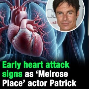 Early heart attack signs as ‘Melrose Place’ actor Patrick Muldoon dies at 57