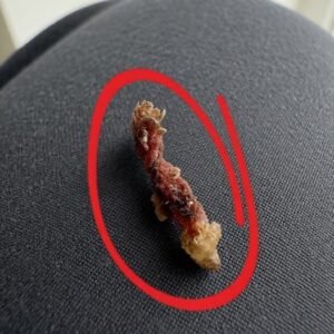I Woke Up in the Middle of the Night Convinced Something Was Biting My Skin
