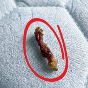 I woke up feeling like something was biŧing my upper back.