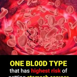 If you have a certain blood type, you’re MORE likely to develop cancer, research suggests