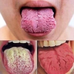 What Changes in Your Tongue May Say About Your Overall Well-Being