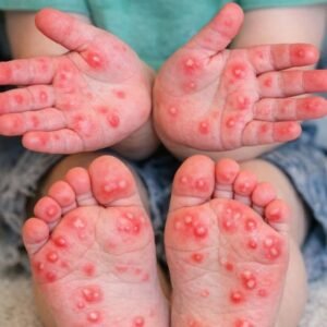 Apply this 1 mixture to your fingernails and get rid of stubborn yellow tint, white spots, and dullness