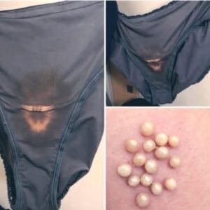 BE CAREFUL, if you notice this in your underwear, it means you have…see below –