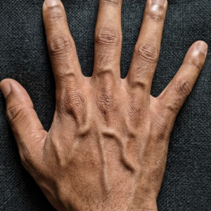 Visible Hand Veins Explained: Why They Appear, From Low Body Fat, Genetics, Exercise, Heat, and Hydration Changes, and When They Are Normal or Rarely a Sign of Medical Concern, Offering Reassurance That Prominent Veins Are Usually Harmless Physical Traits While Highlighting Simple Lifestyle Factors That Influence Their Appearance Over Time Naturally and safely understood today