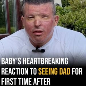A Father’s Worst Nightmare: After a Horrific Acid Attack Left Him Unrecognizable, Would His Own Toddler Still Love Him?