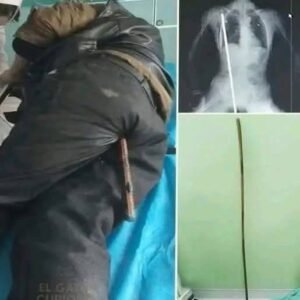 Young man hospitalized after being arrested….
