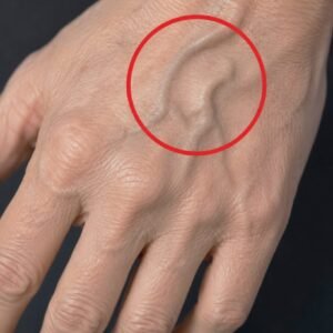 If your veins are visible in your hand, it is a signal