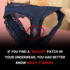 The Disgusting Truth Behind Those Mysterious “Bleach” Stains on Your Underwear